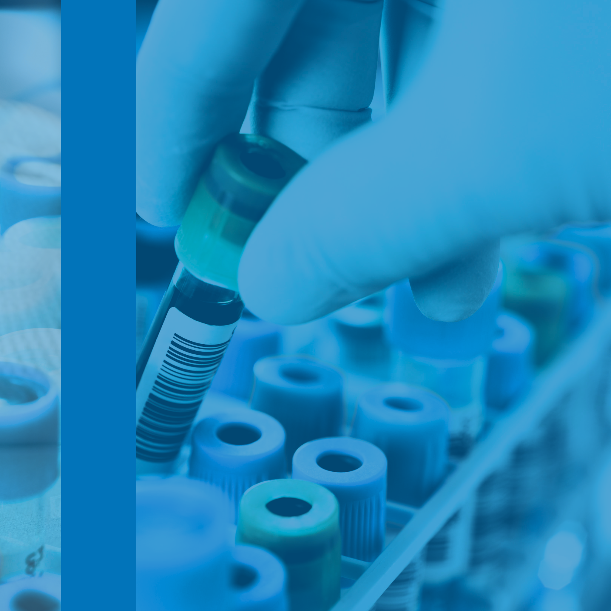 7 Novel Laboratory Tests to Assess Immune Function