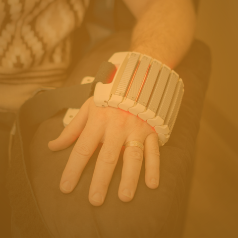 Methylene Blue and Photodynamic Therapy for Skin Conditions