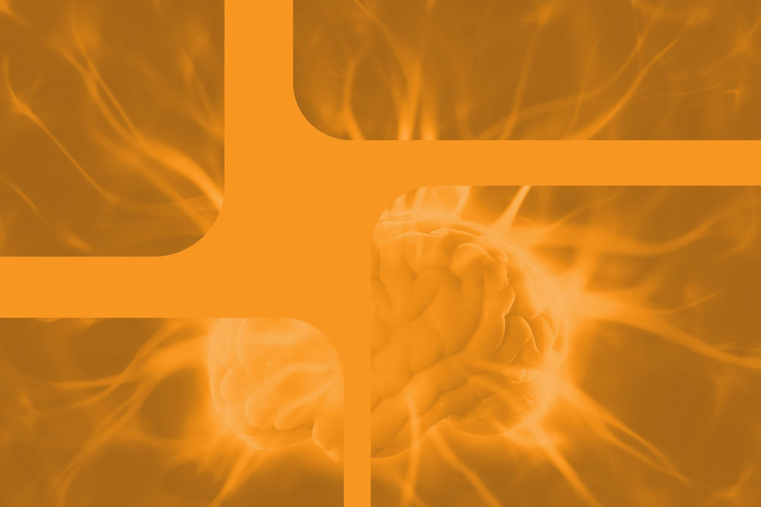 default mode network 