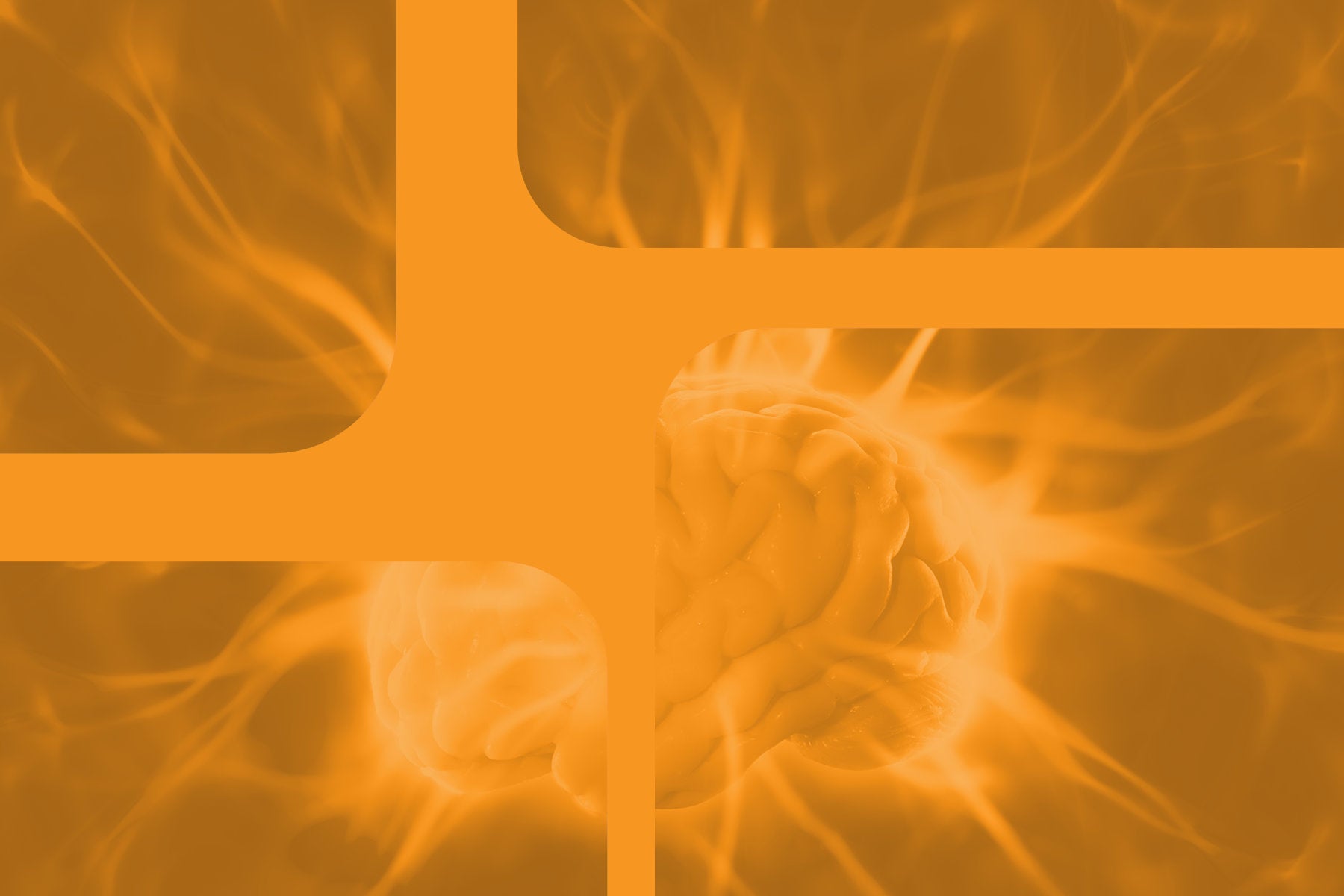 default mode network 